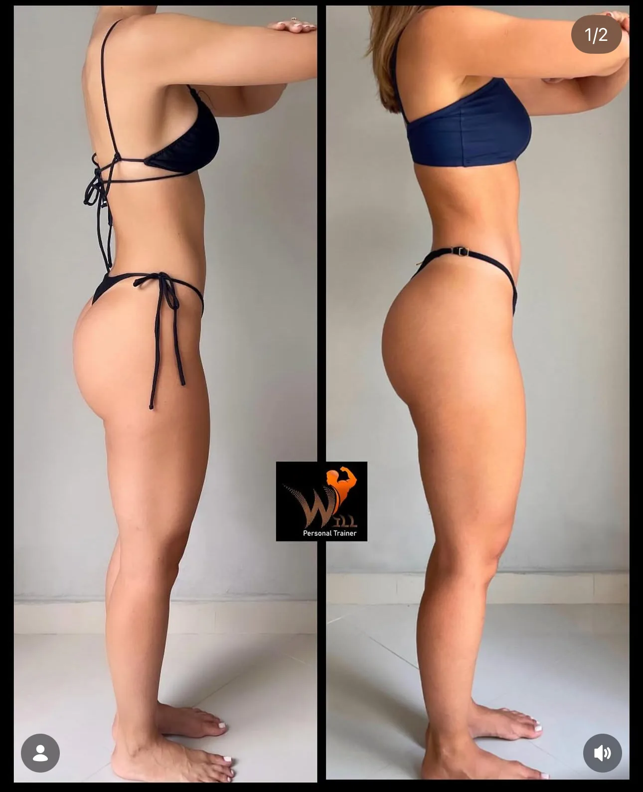 Antes e depois de cliente 9